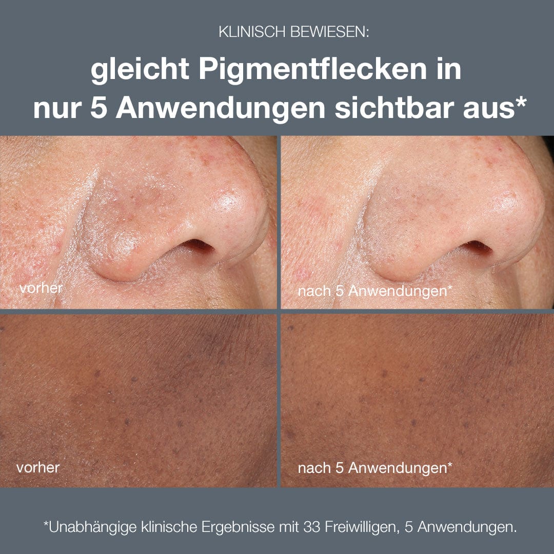 Ein Foto der Nase einer Frau mit einem Presell PowerBright Dark Spot Peel darauf.