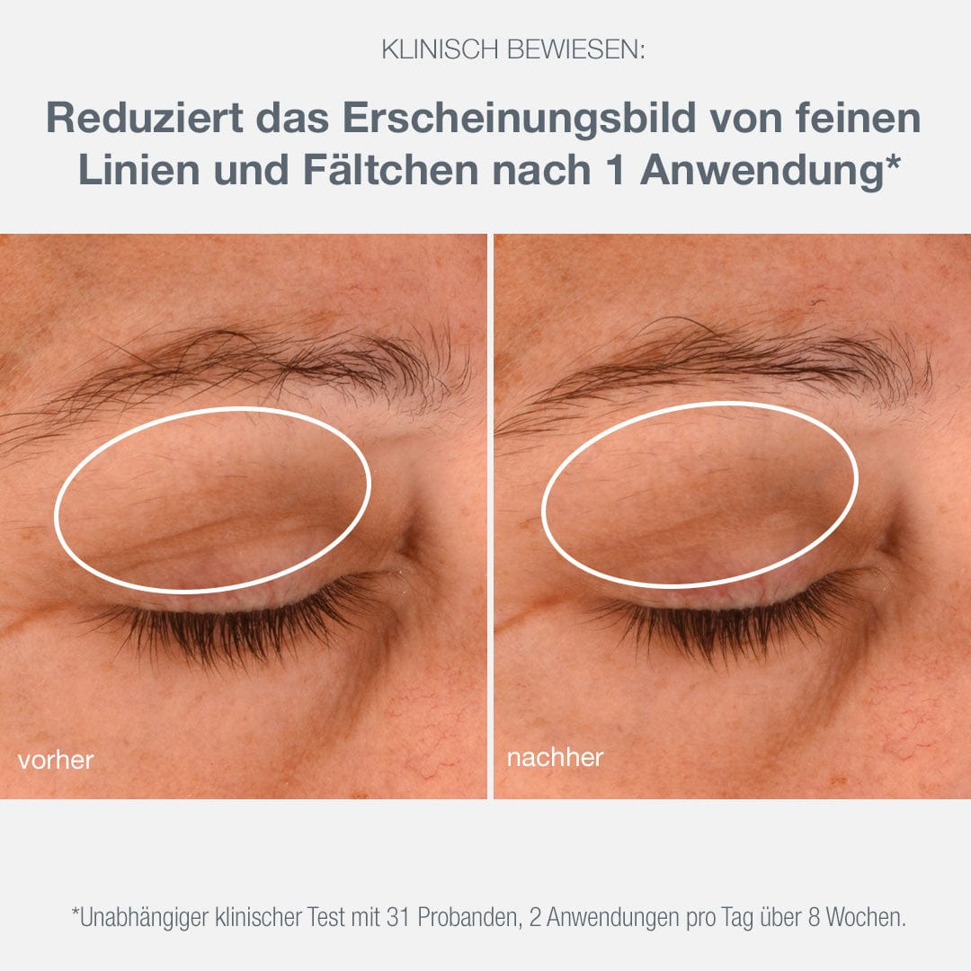 Nahaufnahmevergleich der Augenpartie einer Person vor und nach der Anwendung der Phyto Nature Lifting Eye Cream