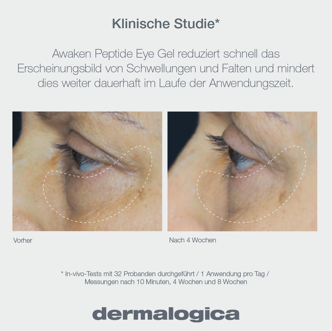 Vorher-Nachherbild der Augenpartie einer Person für Awaken Peptide Eye Gel