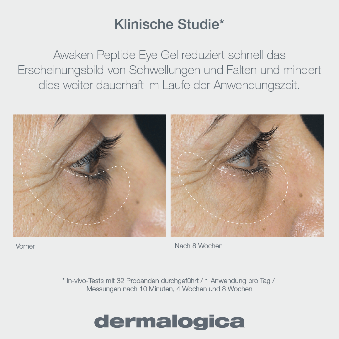 Vorher-Nachherbild der Augenpartie einer Person für Awaken Peptide Eye Gel