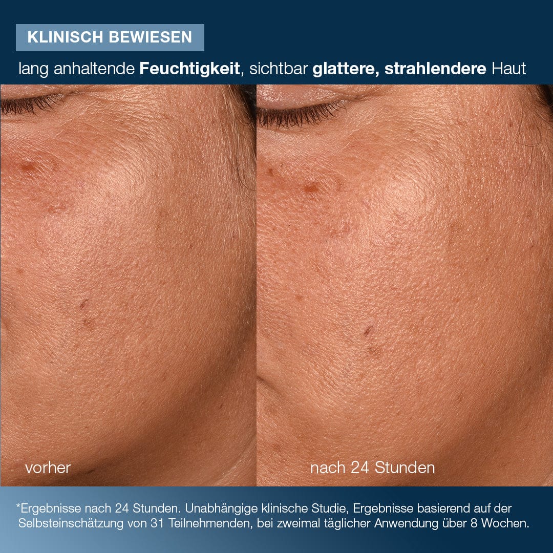Der Vergleich der Gesichtshaut vor und nach 24 Stunden zeigt auf der rechten Seite eine sichtbar glattere, strahlendere Haut. Der deutsche Text hebt die Ergebnisse der klinischen Studie mit Pro-Collagen Banking Water Cream hervor.