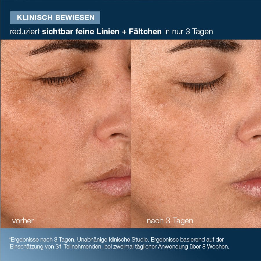 Nebeneinander liegende Nahaufnahmen einer Wangen- und Augenpartie, beschriftet "vorher" und "nach 3 Tagen", zeigen sichtbar reduzierte feine Linien-dank Pro-Collagen Banking Water Cream, ideal zum Erhalt von Kollagen.