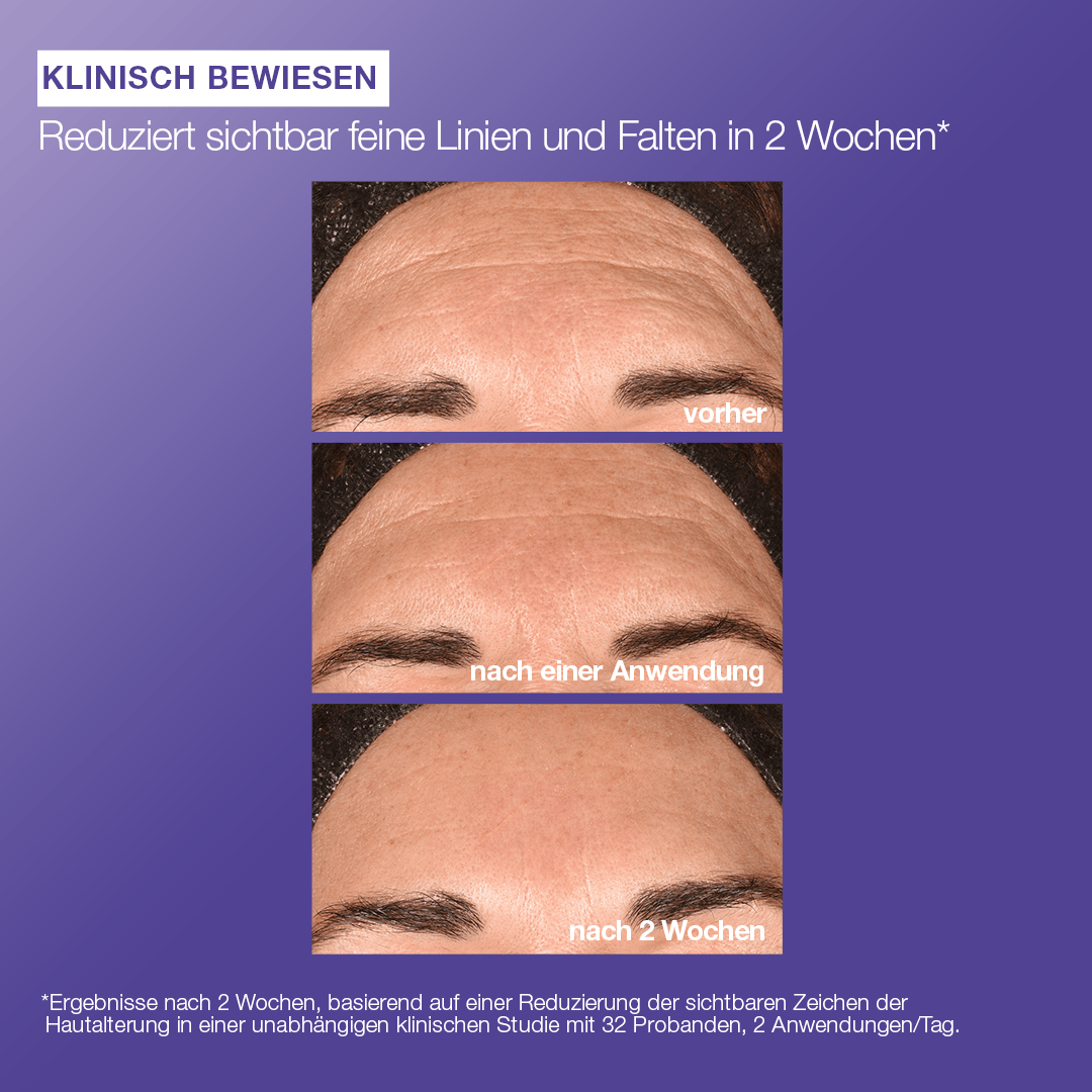 Phyto Nature E² Exosom Treatment