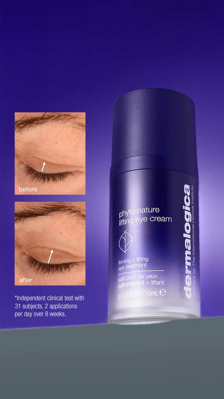 Schlupflider? Nicht mit uns