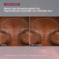 Nahaufnahme der Stirn einer Person, die eine Verringerung der Pigmentflecken vor und nach 8-wöchiger Behandlung mit Dynamic Skin Recovery SPF50 | Tagespflege mit SPF zeigt.