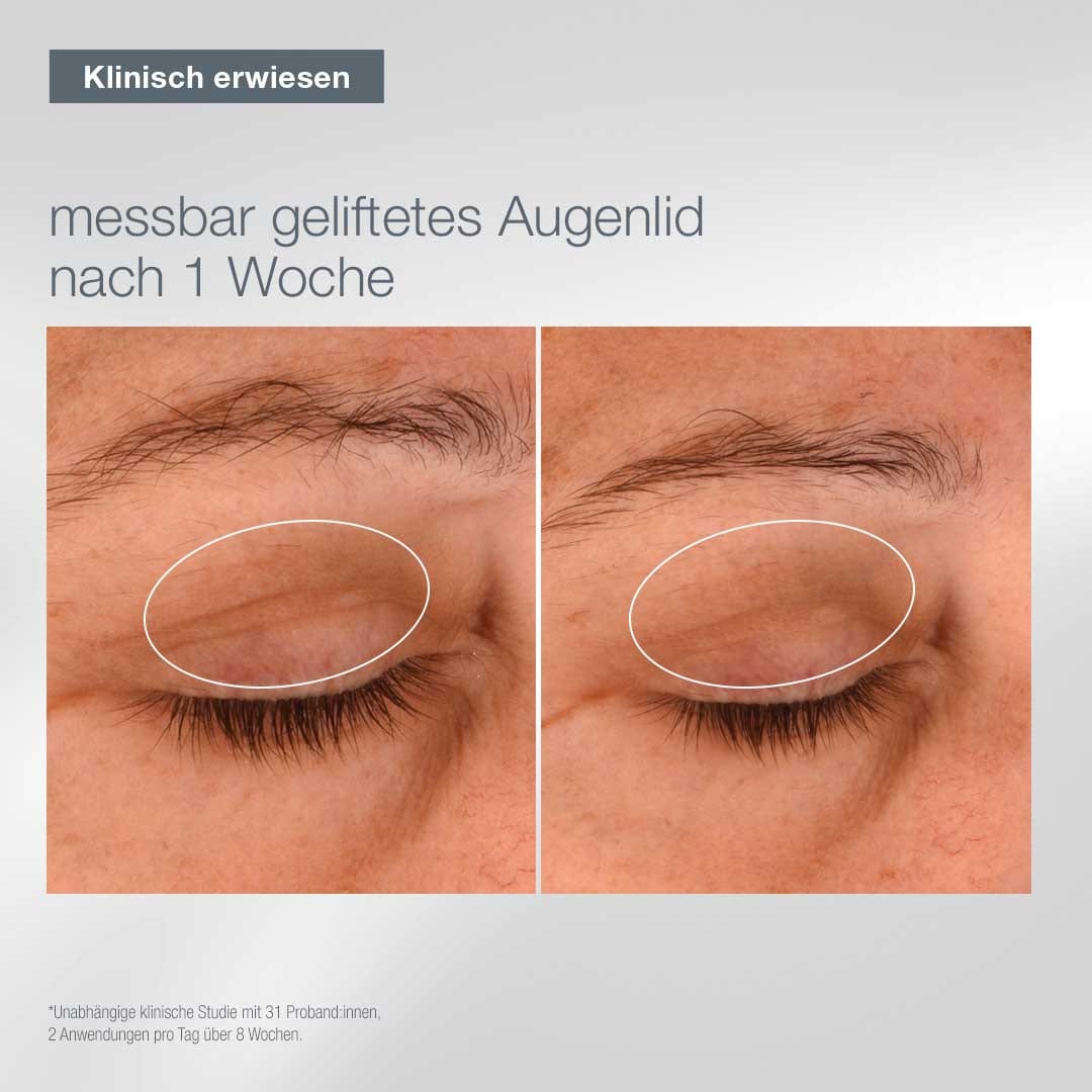 Nahaufnahme eines Augenlids vor und nach einer Woche Anwendung des A Moment in Nature-Sets, das ein sichtbar gestrafftes Augenlid zeigt; der Begleittext hebt die klinisch nachgewiesenen Ergebnisse hervor.