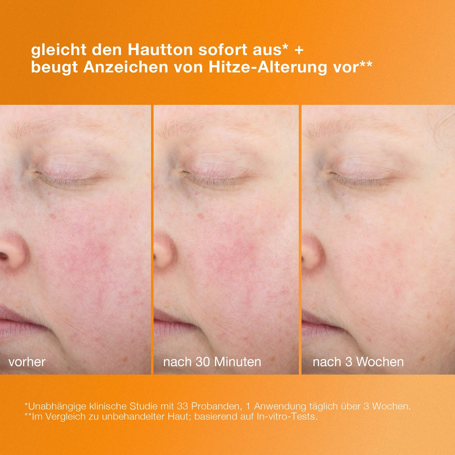 Nahaufnahmevergleich der Wange einer Person, der die Verbesserung des Hautbildes im Zeitverlauf zeigt – vor der Anwendung, nach 30 Minuten und nach 3 Wochen – mit einem deutschen Text über den „Biolumin-C Heat Aging Protector LSF 50“ für einen gleichmäßigen Teint und wirksamen Anti-Aging-Schutz.