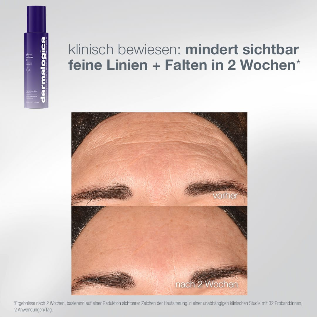 Die Flasche des „Expert Lift Set“ oben links; Vergleichsfotos von Stirnfalten mit den Bezeichnungen „vorher“ und „nach 2 Wochen“; der deutsche Text verspricht eine sichtbare Reduzierung der Falten durch das innovative „Phyto Nature Trio“, das gezielt gegen Hautalterung wirkt und die Langlebigkeit der Haut fördert.