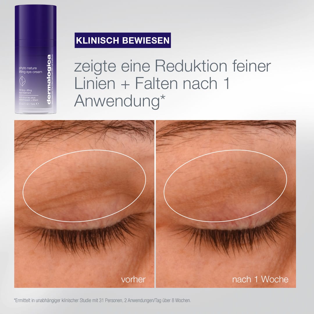Nahaufnahme der Augenpartie vor und nach einer einwöchigen Anwendung des „Expert Lift“-Sets, die die Reduzierung feiner Linien und Falten verdeutlicht – mit sichtbaren Verbesserungen bei der Hautalterung und zur Unterstützung der natürlichen Langlebigkeit der Haut.