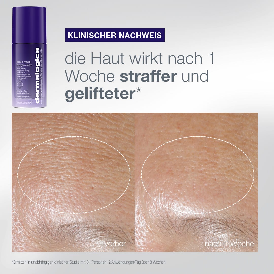 Nahaufnahme der Haut vor und nach einer Woche Anwendung des „The Expert Lift Set“, die eine sichtbar straffere und geliftete Haut für mehr Langlebigkeit der Haut zeigt. Der Text und die Produktflasche sind im Bild zu sehen.