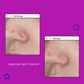 Zwei Bilder zeigen Spot Treatment für unreine Haut für die Nase einer Frau und Post-Breakout Fix.