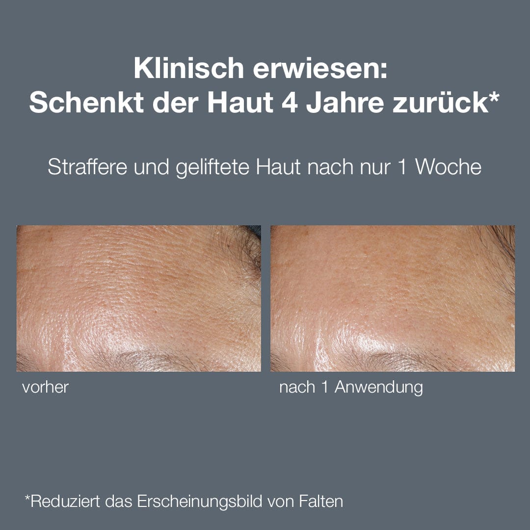 Nahaufnahme von Hautabschnitten vor und nach der Anwendung eines Anti-Falten-Produkts, die eine Verringerung von Falten zeigt.